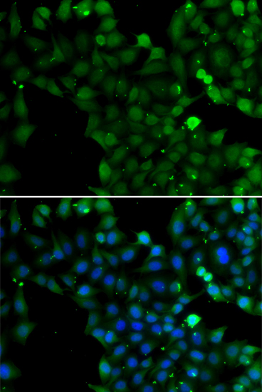 CLIC4 Antibody (OAAN02134) in A549 Cells using Immunofluorescence