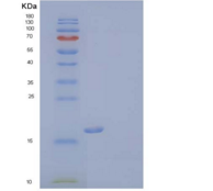 人髓细胞触发受体2(TREM2)重组蛋白C-6His
