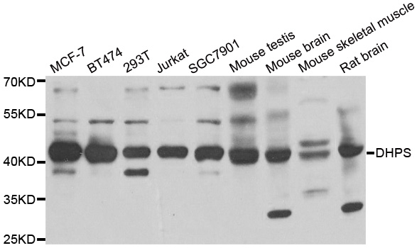 DHPS Antibody (OAAN01757) in Multiple Cell Lines using Western Blot