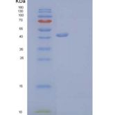 小鼠GITR/TNFRSF18/CD357重组蛋白C-Fc-6His