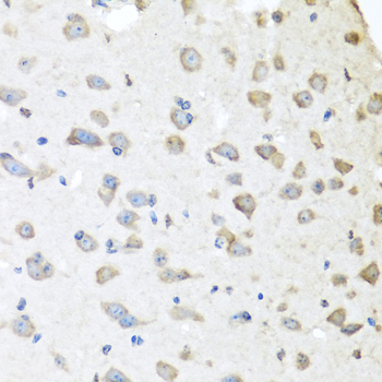 APCS Antibody (OAAN00656) in Mouse Brain using Immunohistochemistry
