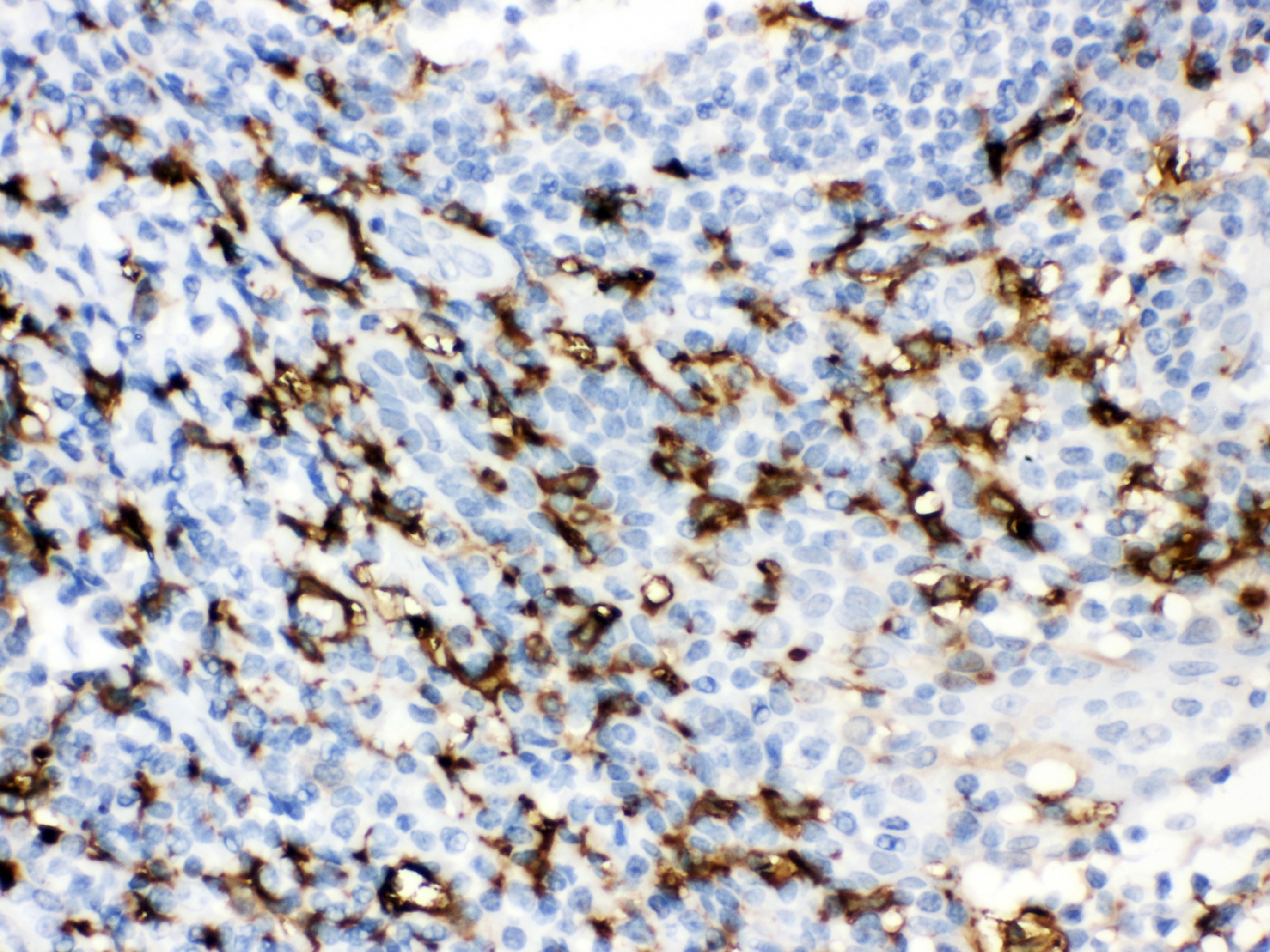 IBA1 Antibody - C-terminal region (OABB02125) in Human Tonsil Tissue using Immunohistochemistry