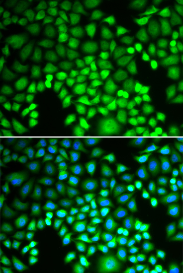 PSMA4 Antibody (OAAN00860) in U20S Cells using Immunofluorescence