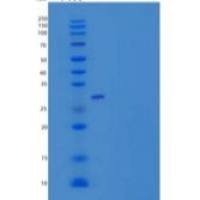 人激肽释放酶2(KLK2)重组蛋白C-6His