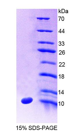 SLC30A8 Recombinant Protein (OPCD07032) using SDS-PAGE