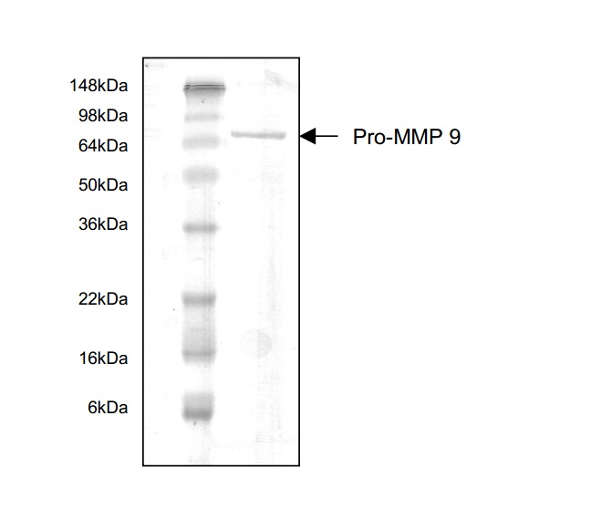 Pro-Matrix Metalloproteinase 9 Protein (OPRB00249) in human Pro-MMP-9 using Western Blot