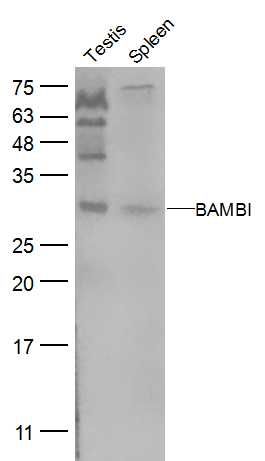肿瘤转移抑制蛋白BAMBI抗体