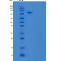 人膜联蛋白A6(ANXA6)重组蛋白C-6His