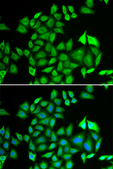 PSMA3 Antibody (OAAN00319) in U20S Cells using Immunofluorescence