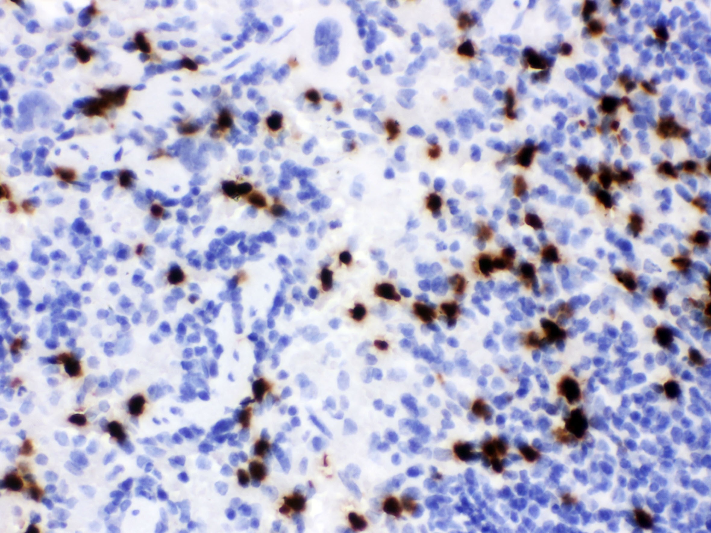 LIPOCALIN 2 Antibody (OABB02091) in Mouse Spleen Tissue using Immunohistochemistry