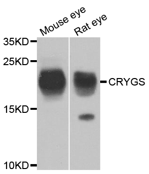 CRYGS Antibody (OAAN02491) in Mouse Eye using Western Blot