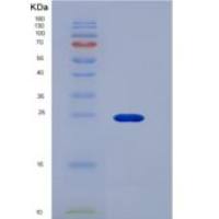 人CD16a / FCGR3A重组蛋白176 Phe, His & AVI tag