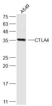 细胞毒性T细胞抗原-4抗体