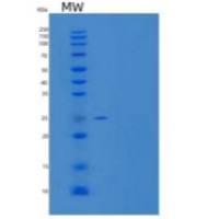 人胶质瘤发病相关蛋白1重组蛋白