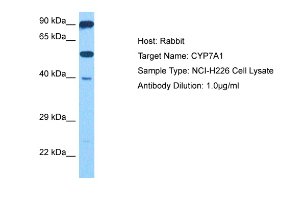 CYP7A1 Antibody - middle region (ARP78930_P050) in Human NCI-H226 Whole Cell using Western Blot