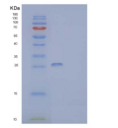 人CMRF35样分子9重组蛋白