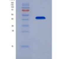 人钙调蛋白1(CALM1)重组蛋白