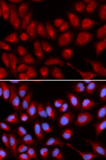 IL16 Antibody (OAAN00516) in U20S Cells using Immunofluorescence