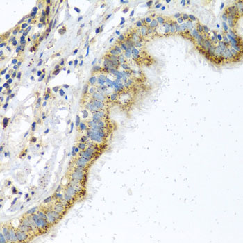 ATPIF1 Antibody (OAAN01164) in Human Trachea using Immunohistochemistry