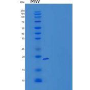 小鼠含V-Set免疫球蛋白域蛋白4(VSIG4)重组蛋白C-6His