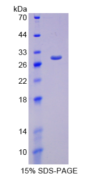 NFKBIE Recombinant Protein (OPCD04218) using SDS-PAGE