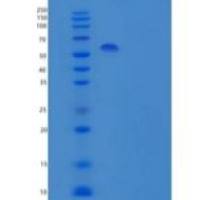 人干扰素α/β受体2/干扰素受体2重组蛋白C-Fc