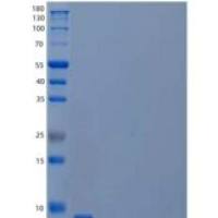 人C-X-C基序趋化因子5/CXCL5重组蛋白
