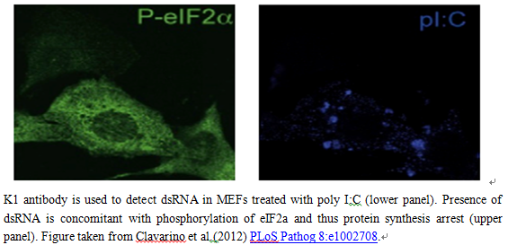 抗双链RNA抗体 （anti dsRNA antibody1