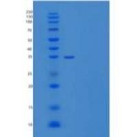 小鼠Poliovirus Receptor重组蛋白