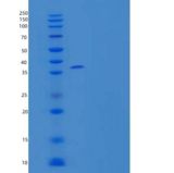 人DNA断裂因子亚单位α/DFFA/DFF45/ICAD重组蛋白N-6His
