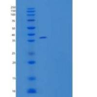 人DNA断裂因子亚单位α/DFFA/DFF45/ICAD重组蛋白N-6His