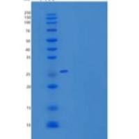 小鼠UCHL1 / PGP9.5重组蛋白His tag