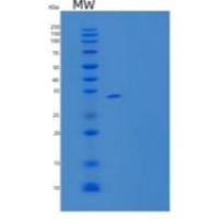 人脱氧胞苷激酶(DCK)重组蛋白N-6His, T7 tag