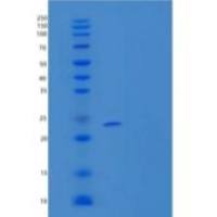 小鼠甘露糖结合凝集素2/MBL-2/MBP-C重组蛋白
