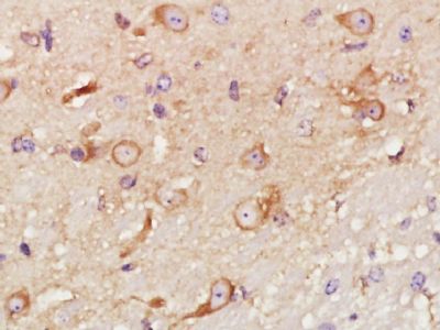 SOX2胚胎干细胞关键蛋白抗体