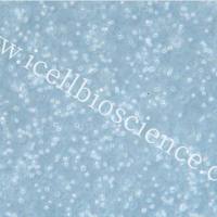 Toledo、Toledo细胞、人弥漫大B细胞淋巴瘤细胞/STR鉴定/镜像绮点（Cellverse）