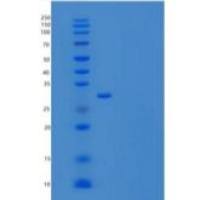 人氯化物细胞内通道蛋白1(CLIC1)重组蛋白N-6His