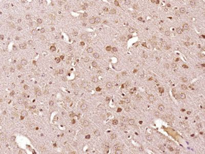 一种肿瘤抑制基因免疫荧光抗体(C端)