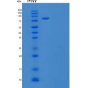 小鼠PDGF R α/PDGFRA/CD140a重组蛋白C-Fc