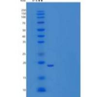 人UBE2W重组蛋白His tag