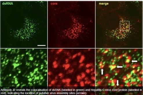 抗双链RNA抗体 （anti dsRNA antibody1