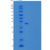 人Syntenin-1/SDCBP/SYCL/MDA9重组蛋白C-6His