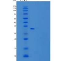 人Syntenin-1/SDCBP/SYCL/MDA9重组蛋白C-6His