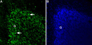 Anti-Two Pore Calcium Channel 