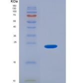 人IgG-Fc片段低亲和力受体Ⅲb(FcgR3B)重组蛋白