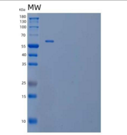 人补体因子H相关蛋白5(CFHR5)重组蛋白C-6His