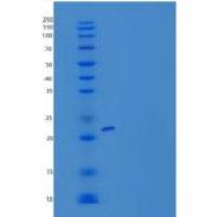 人白血病抑制因子(LIF)重组蛋白His Tag