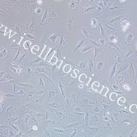 HCC-44、HCC-44细胞、HCC44细胞、HCC44、人非小细胞肺癌细胞/STR鉴定/镜像绮点(Cellverse)