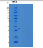 人SLAM家族成员5/SLAMF5/CD84重组蛋白C-6H
