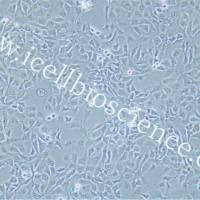 NCI-H2009 | NCI-H2009细胞 | 人肺腺癌细胞 | STR鉴定 | 镜像绮点